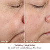 Dr. Dennis Gross Skincare Advanced Retinol + Ferulic Texture Renewal Serum