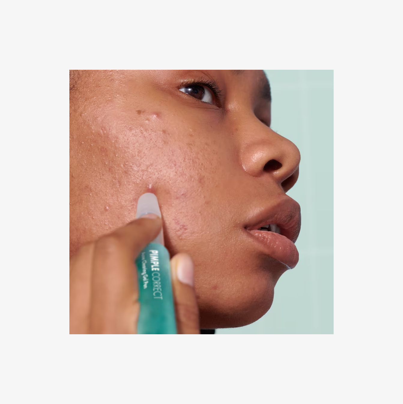 Hero Cosmetics Pimple Correct Gel en Pluma Antiacné