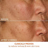 Dr. Dennis Gross Skincare Sérum Vitamina C Láctico 15% Reafirmante e Iluminador