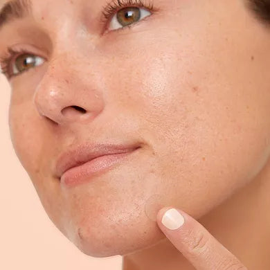 Peace Out Salicylic Acid Acne Healing Dots
